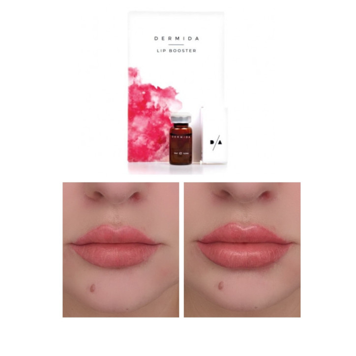 DERMIDA® Lip Booster ( výživa, hydratácia a objem pier ) 10 ml