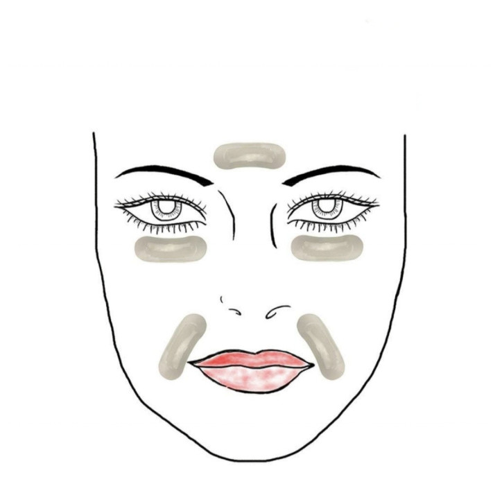 Mikroihličkové náplasti na okolie očí a nasolabiálne vrásky - 1 pár