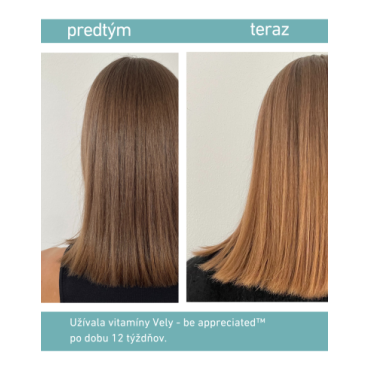 VELY be appreciated™ Gumené vitamíny pre silné vlasy