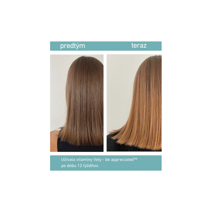 VELY be appreciated™ Gumené vitamíny pre silné vlasy