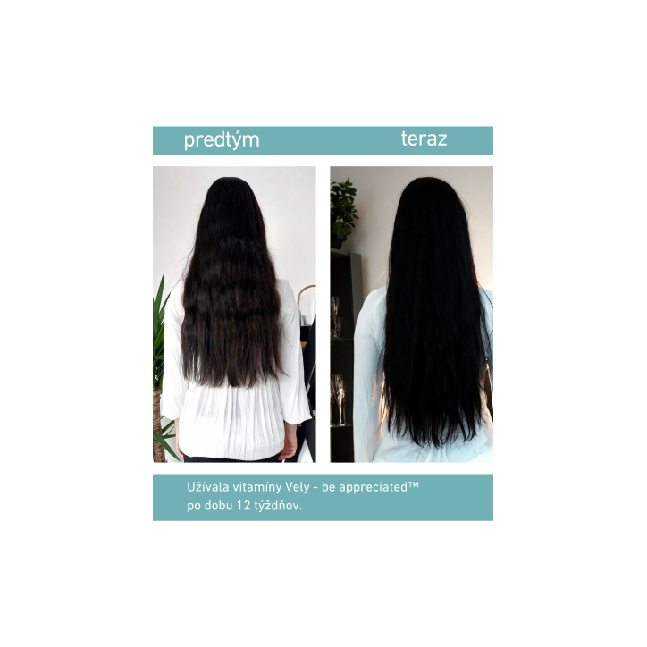 VELY be appreciated™ Gumené vitamíny pre silné vlasy