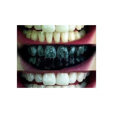 Bieliaci púder Carbon Coco 15g