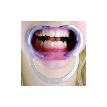 Roztvárač úst - 5ks