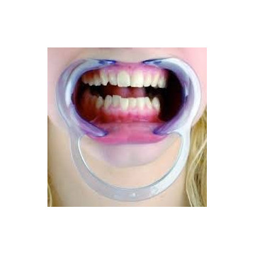 Roztvárač úst - 10ks